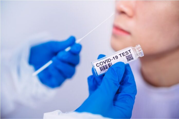 Test nhanh kháng nguyên là gì? Bộ kit Humasis được cấp phép