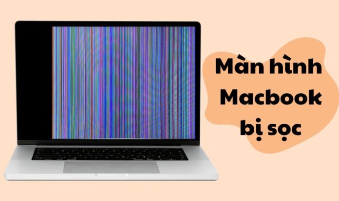 Màn hình Macbook bị sọc